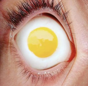 This eye is no yolk